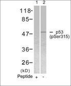 Anti-phospho-TP53 (pSer315) antibody produced in rabbit affinity isolated antibody