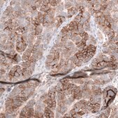 Monoclonal Anti-Msln Antibody Produced In Mouse Prestige Antibodies® Powered by Atlas Antibodies, clone CL13956, affinity isolated antibody, buffered aqueous glycerol solution