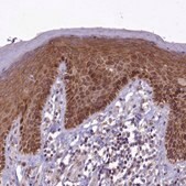 Anti-ABCB8 antibody produced in rabbit Prestige Antibodies&#174; Powered by Atlas Antibodies, affinity isolated antibody, buffered aqueous glycerol solution