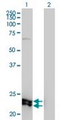 Monoclonal Anti-DSU antibody produced in mouse clone 8F9-1B2, purified immunoglobulin, buffered aqueous solution