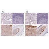 Anti-RPTN antibody produced in rabbit Prestige Antibodies® Powered by Atlas Antibodies, affinity isolated antibody, buffered aqueous glycerol solution
