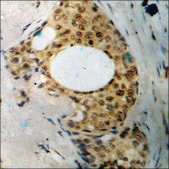 Anti-phospho-XIAP (pSer87) antibody produced in rabbit affinity isolated antibody