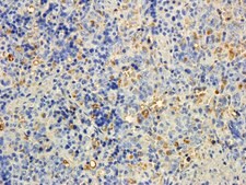 Anti-MTMR9 (C-terminal) antibody produced in goat affinity isolated antibody, buffered aqueous solution