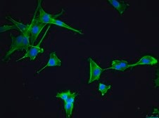 OSUMMER.13 Mouse NRAS-Mutant Melanoma Cell Line