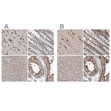 Anti-ERLEC1 antibody produced in rabbit Prestige Antibodies® Powered by Atlas Antibodies, affinity isolated antibody, buffered aqueous glycerol solution, ab2