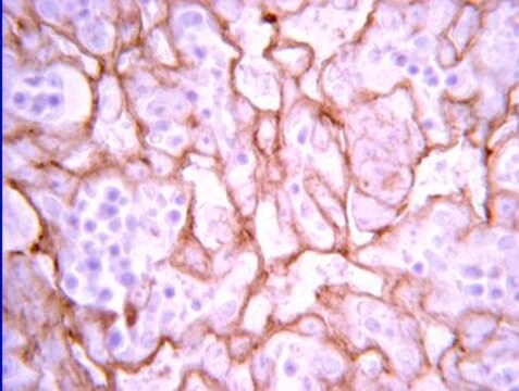 Anti-VEGF Antibody from rabbit, purified by affinity chromatography