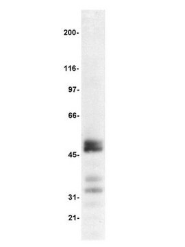 Anti-TCF-1 Antibody, clone 7H3 clone 7H3, Upstate&#174;, from mouse