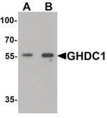 Anti-GHDC antibody produced in rabbit affinity isolated antibody