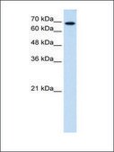 Anti-RPN2 antibody produced in rabbit affinity isolated antibody