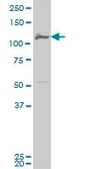 ANTI-MCM3 antibody produced in mouse clone 2A11, purified immunoglobulin, buffered aqueous solution