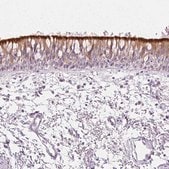 Anti-ROPN1L antibody produced in rabbit affinity isolated antibody, buffered aqueous glycerol solution