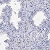 Anti-PPP1R32 antibody produced in rabbit Prestige Antibodies&#174; Powered by Atlas Antibodies, affinity isolated antibody, buffered aqueous glycerol solution