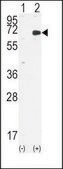Anti-RAD23B (N-term) antibody produced in rabbit IgG fraction of antiserum, buffered aqueous solution