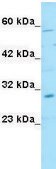 Anti-SNAI1 affinity isolated antibody