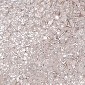 Monoclonal Anti-FOLH1 antibody produced in mouse Prestige Antibodies® Powered by Atlas Antibodies, clone CL9089, purified immunoglobulin, buffered aqueous glycerol solution