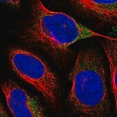 Anti-VAT1L antibody produced in rabbit Prestige Antibodies&#174; Powered by Atlas Antibodies, affinity isolated antibody, buffered aqueous glycerol solution