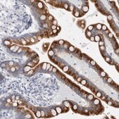 Anti-B3GNT3 antibody produced in rabbit Prestige Antibodies&#174; Powered by Atlas Antibodies, affinity isolated antibody, buffered aqueous glycerol solution