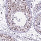 Anti-DOCK11 antibody produced in rabbit Prestige Antibodies&#174; Powered by Atlas Antibodies, affinity isolated antibody, buffered aqueous glycerol solution