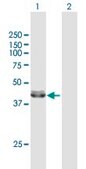 Anti-ACADM antibody produced in mouse purified immunoglobulin, buffered aqueous solution