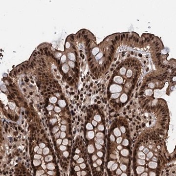 Anti-ANKRD49 antibody produced in rabbit Prestige Antibodies&#174; Powered by Atlas Antibodies, affinity isolated antibody, buffered aqueous glycerol solution