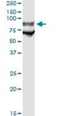 Monoclonal Anti-GP1BA antibody produced in mouse clone 1C6, purified immunoglobulin, buffered aqueous solution
