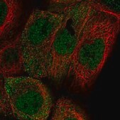 Anti-ADIRF antibody produced in rabbit Prestige Antibodies&#174; Powered by Atlas Antibodies, affinity isolated antibody, buffered aqueous glycerol solution