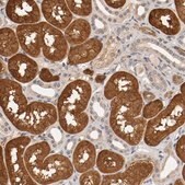 Anti-TNFRSF1B antibody produced in rabbit Prestige Antibodies® Powered by Atlas Antibodies, affinity isolated antibody, buffered aqueous glycerol solution