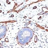 Anti-&#945;-Actin-1 (ATCA1) antibody produced in rabbit