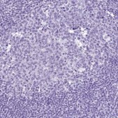 Anti-STATH antibody produced in rabbit Prestige Antibodies&#174; Powered by Atlas Antibodies, affinity isolated antibody, buffered aqueous glycerol solution