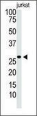 Anti-Mouse Tlr9 (C-term) antibody produced in rabbit IgG fraction of antiserum, buffered aqueous solution