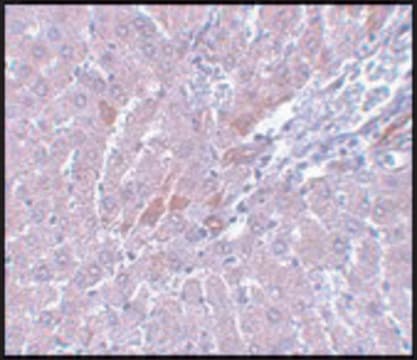 Anti-LYRM1 antibody produced in rabbit affinity isolated antibody, buffered aqueous solution