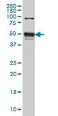 Monoclonal Anti-STK38 antibody produced in mouse clone 3A5, purified immunoglobulin, buffered aqueous solution