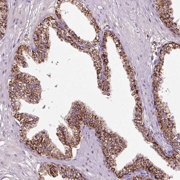 Anti-LRRC24 antibody produced in rabbit Prestige Antibodies&#174; Powered by Atlas Antibodies, affinity isolated antibody, buffered aqueous glycerol solution