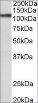 Anti-TPO antibody produced in goat affinity isolated antibody, buffered aqueous solution