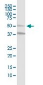 Anti-MLKL antibody produced in mouse purified immunoglobulin, buffered aqueous solution