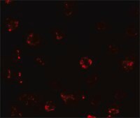 Anti-TESPA1 antibody produced in rabbit affinity isolated antibody