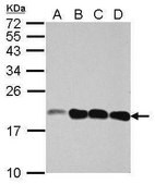 Anti-NCALD antibody produced in rabbit affinity isolated antibody, buffered aqueous solution
