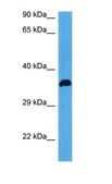Anti-PIM1, (N-terminal) antibody produced in rabbit affinity isolated antibody
