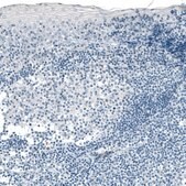 Monoclonal Anti-CPA1 antibody produced in mouse Prestige Antibodies&#174; Powered by Atlas Antibodies, clone CL6629, purified immunoglobulin, buffered aqueous glycerol solution