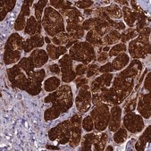 Anti-ECE2 antibody produced in rabbit Prestige Antibodies&#174; Powered by Atlas Antibodies, affinity isolated antibody, buffered aqueous glycerol solution