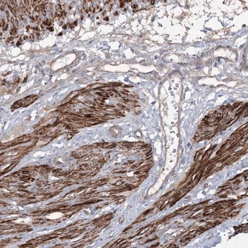 Anti-ZSWIM6 antibody produced in rabbit Prestige Antibodies&#174; Powered by Atlas Antibodies, affinity isolated antibody, buffered aqueous glycerol solution