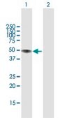 Anti-LIPA antibody produced in rabbit purified immunoglobulin, buffered aqueous solution