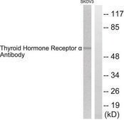 Anti-Thyroid Hormone Receptor &#945;, N-Terminal antibody produced in rabbit affinity isolated antibody