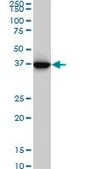 Monoclonal Anti-GLUL, (C-terminal) antibody produced in mouse clone 3B6, purified immunoglobulin, buffered aqueous solution