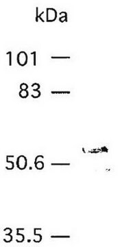 Anti-MMP-3 (Ab-1) Mouse mAb (55-2A4) liquid, clone 55-2A4, Calbiochem&#174;