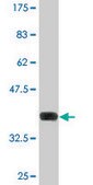 Monoclonal Anti-NTE, (C-terminal) antibody produced in mouse clone 3D10, purified immunoglobulin, buffered aqueous solution