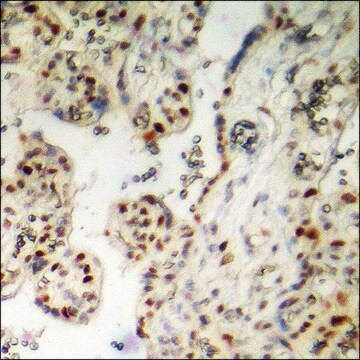 Anti-phospho-AML1 (pSer303) antibody produced in rabbit affinity isolated antibody