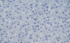 Anti-SOD1 Antibody, clone 1G13 ZooMAb&#174; Mouse Monoclonal recombinant, expressed in HEK 293 cells