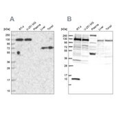 Anti-PPP4R1 antibody produced in rabbit Prestige Antibodies® Powered by Atlas Antibodies, affinity isolated antibody, buffered aqueous glycerol solution