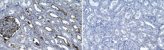 Anti-Fibrin Antibody, clone 59D8 ZooMAb&#174; Mouse Monoclonal recombinant, expressed in HEK 293 cells